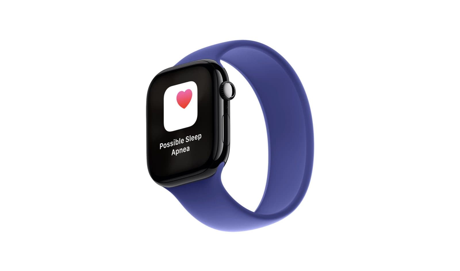 รายงานชี้ Apple Watch ครองเกือบทั้งหมดของตลาดสมาร์ทวอทช์ Edge AI ในไตรมาสแรกปี 2026