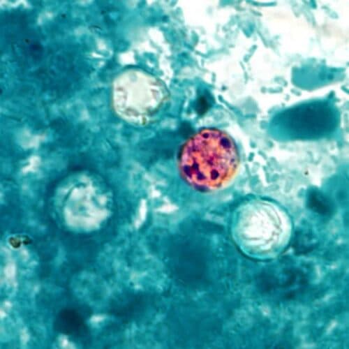 FDA เปิดสอบสวนการระบาด Cyclospora รอบใหม่ พบผู้ป่วยแล้ว 72 ราย