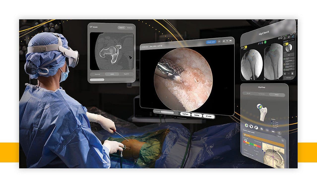Apple Vision Pro ถูกใช้ในการผ่าตัดครั้งแรกผ่านแอปใหม่ของ Stryker
